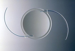 Visualization of cataract eye surgery performed by Brighton Eye Associates in Brooklyn, NY